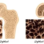 خطرات استفاده بی‌رویه از مصرف نمک